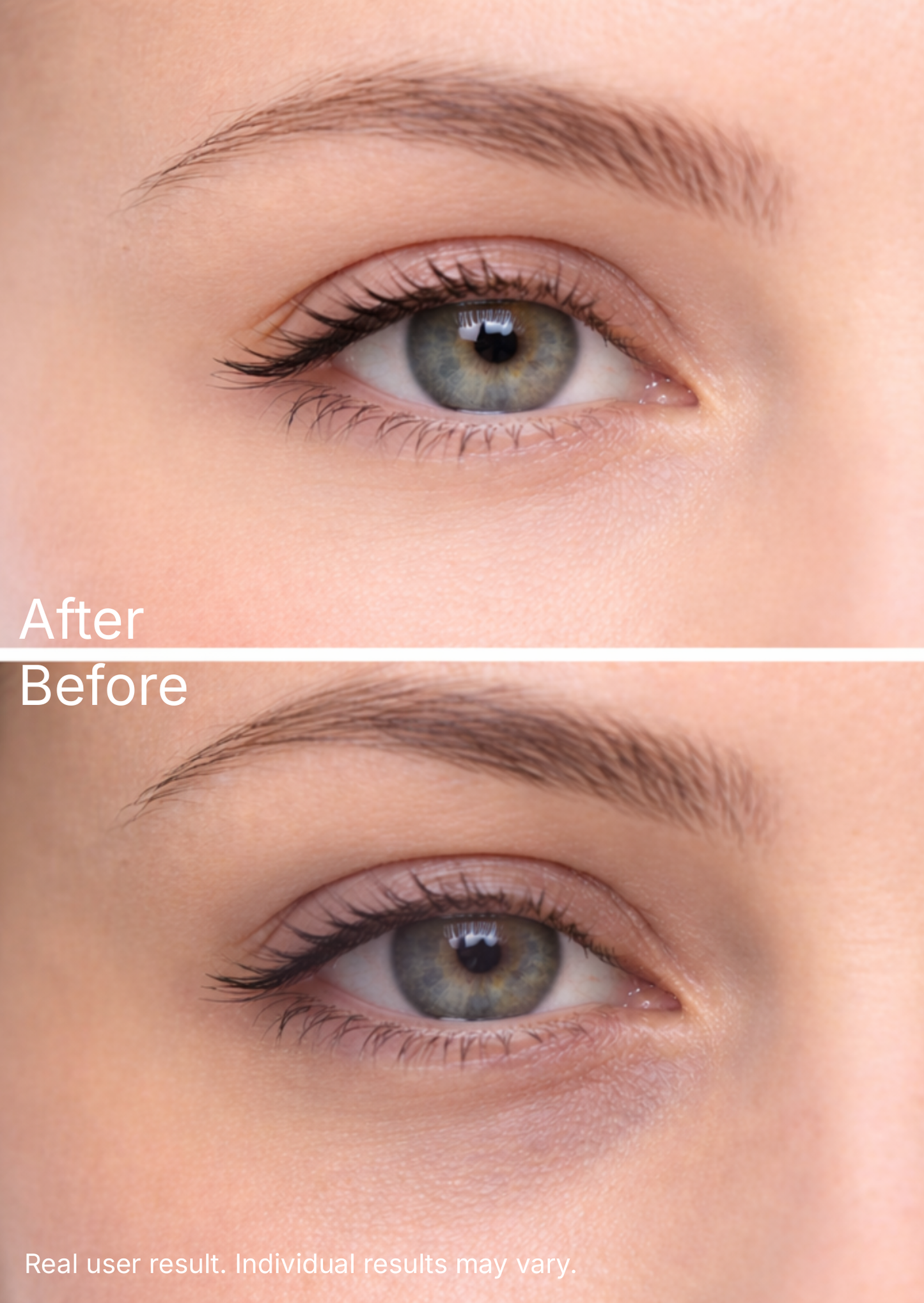The Eye Lab™ Thermal Eye Device